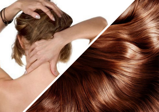 Шейный остеохондроз - заболевание, которое может привести к серьезному выпадению волос